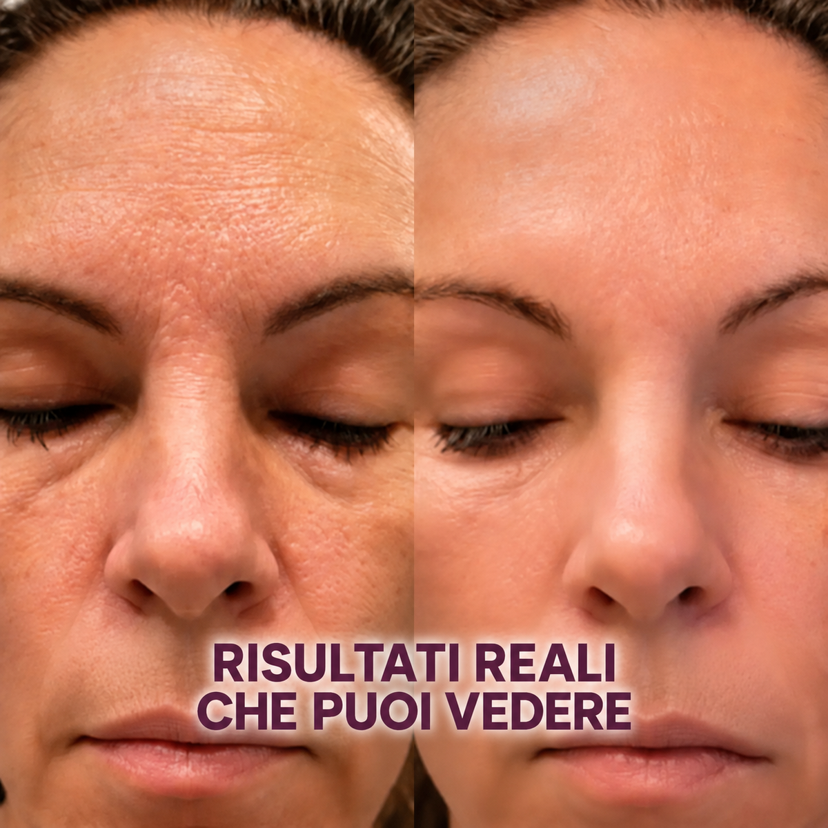 Stick PDRN & Collagene – Una pelle visibilmente rimpolpata in un solo gesto.