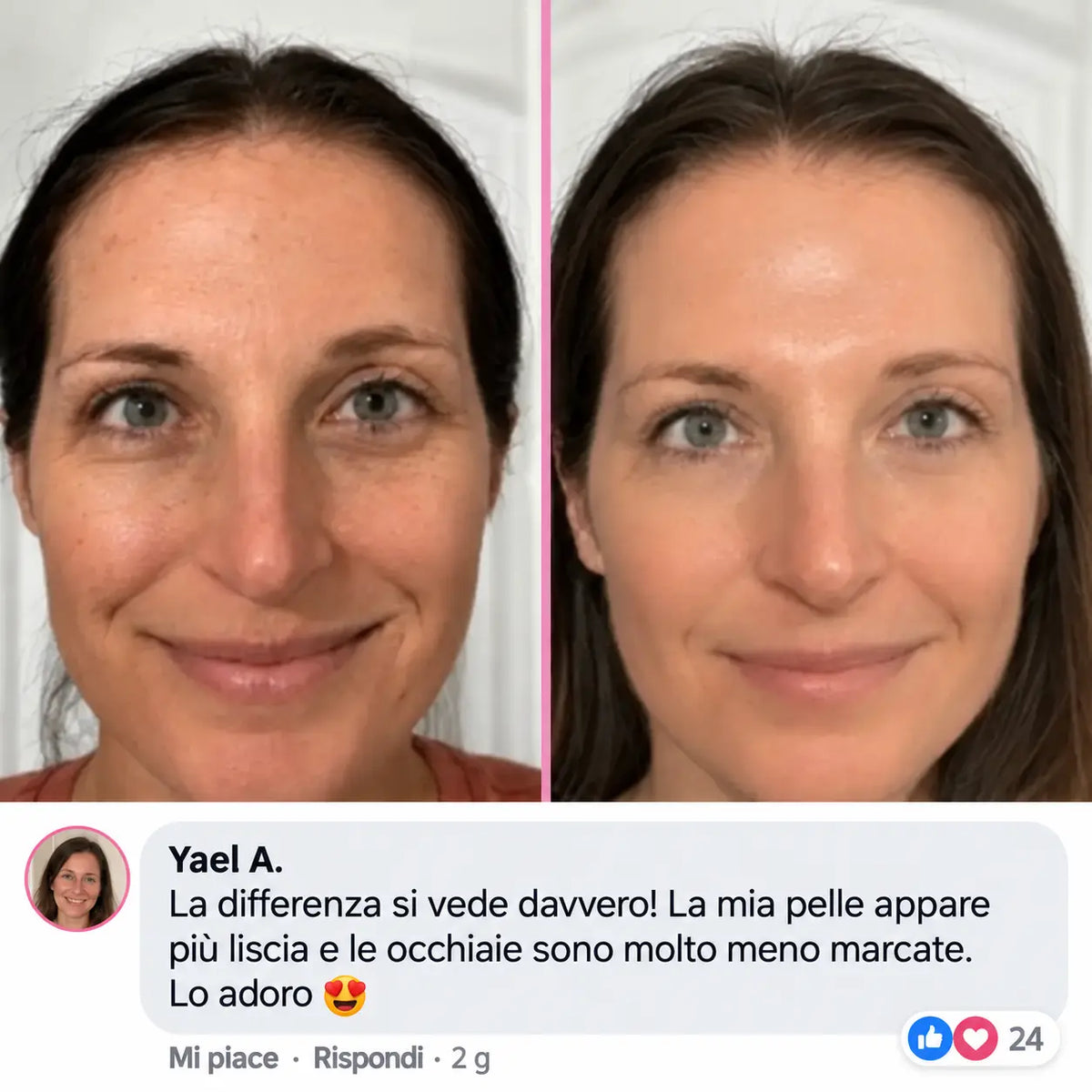 Stick PDRN & Collagene – Una pelle visibilmente rimpolpata in un solo gesto.